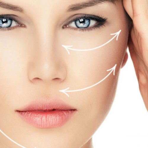 Facelifting 1