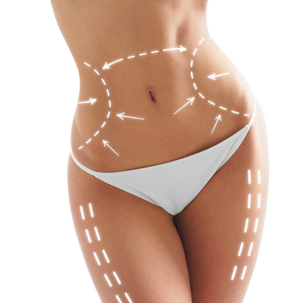 Lipoescultura 2